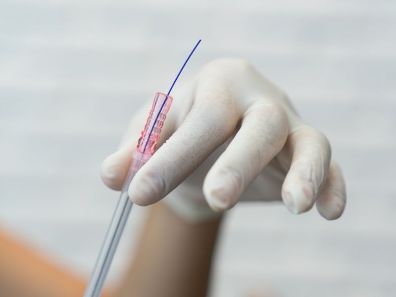 Fios de PDO Realmente Funcionam? Veja Como Eles Levantam o Rosto Sem Cortes