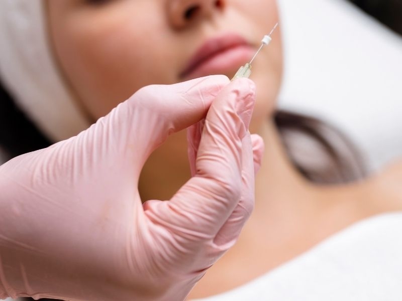 Fios De PDO: Quanto Tempo Dura O Efeito E Quando Reaplicar?