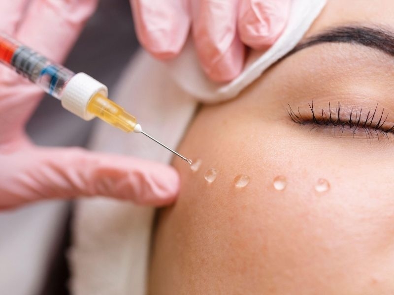 Com Quantos Anos Posso Fazer Bioestimulador de Colágeno?