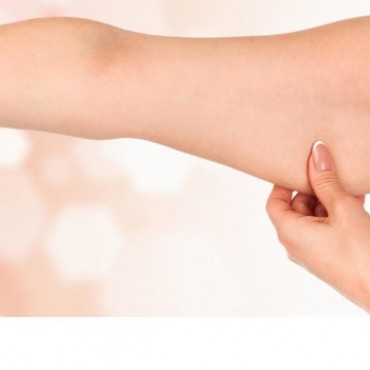 Tratamentos para Flacidez em Mont'Serrat